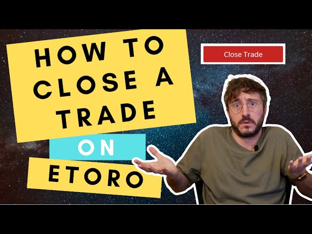 Why were my options positions closed? | eToro Help