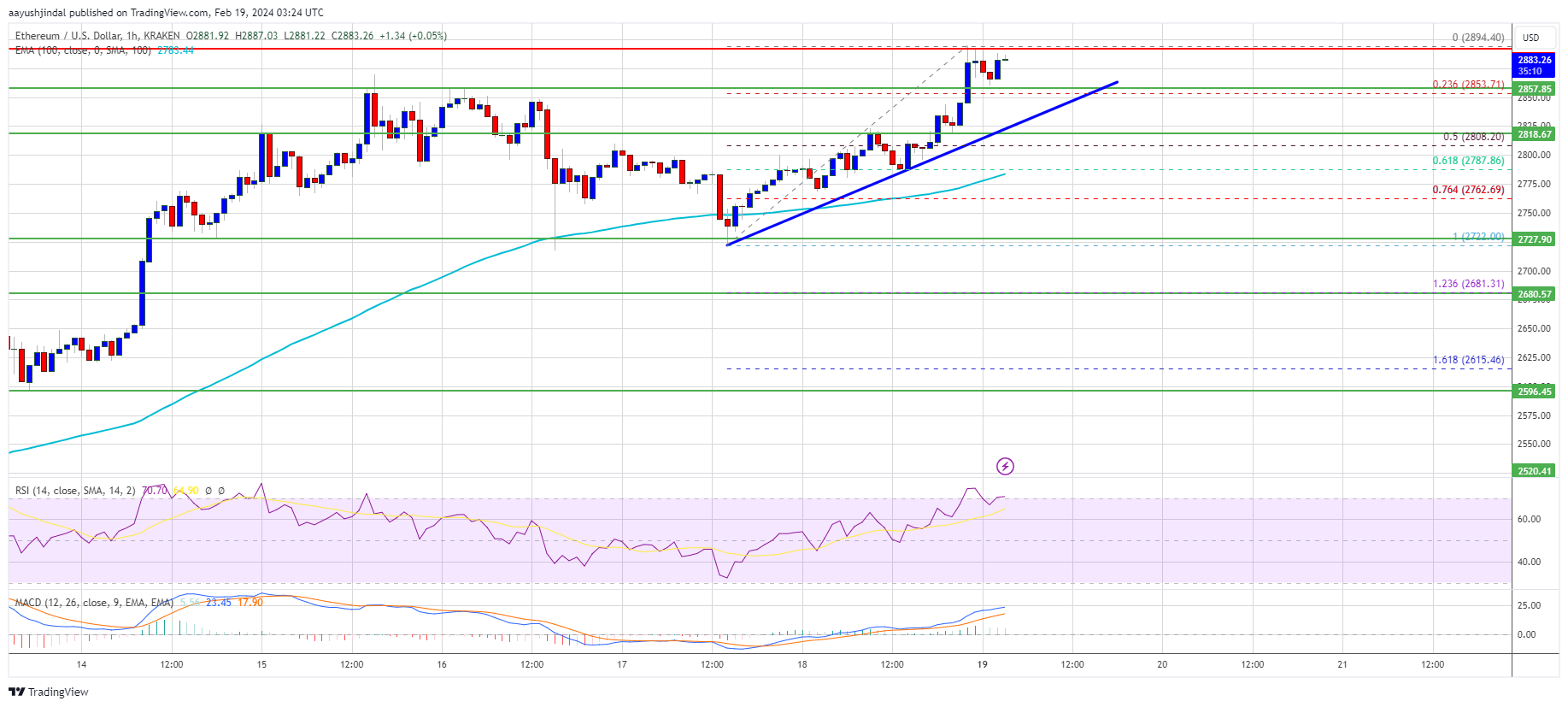 ETHEREUM - ETH/USD Trading signals